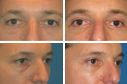 Before & After Photos